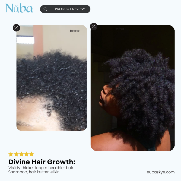 Nuba Divine Hair Elixir hair growth before and after. hair loss treatment